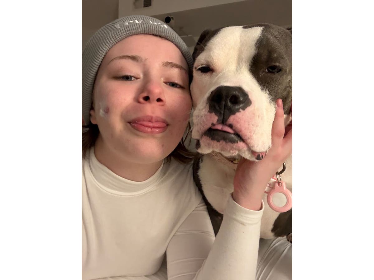 Sadie and her support animal, Daffodil.