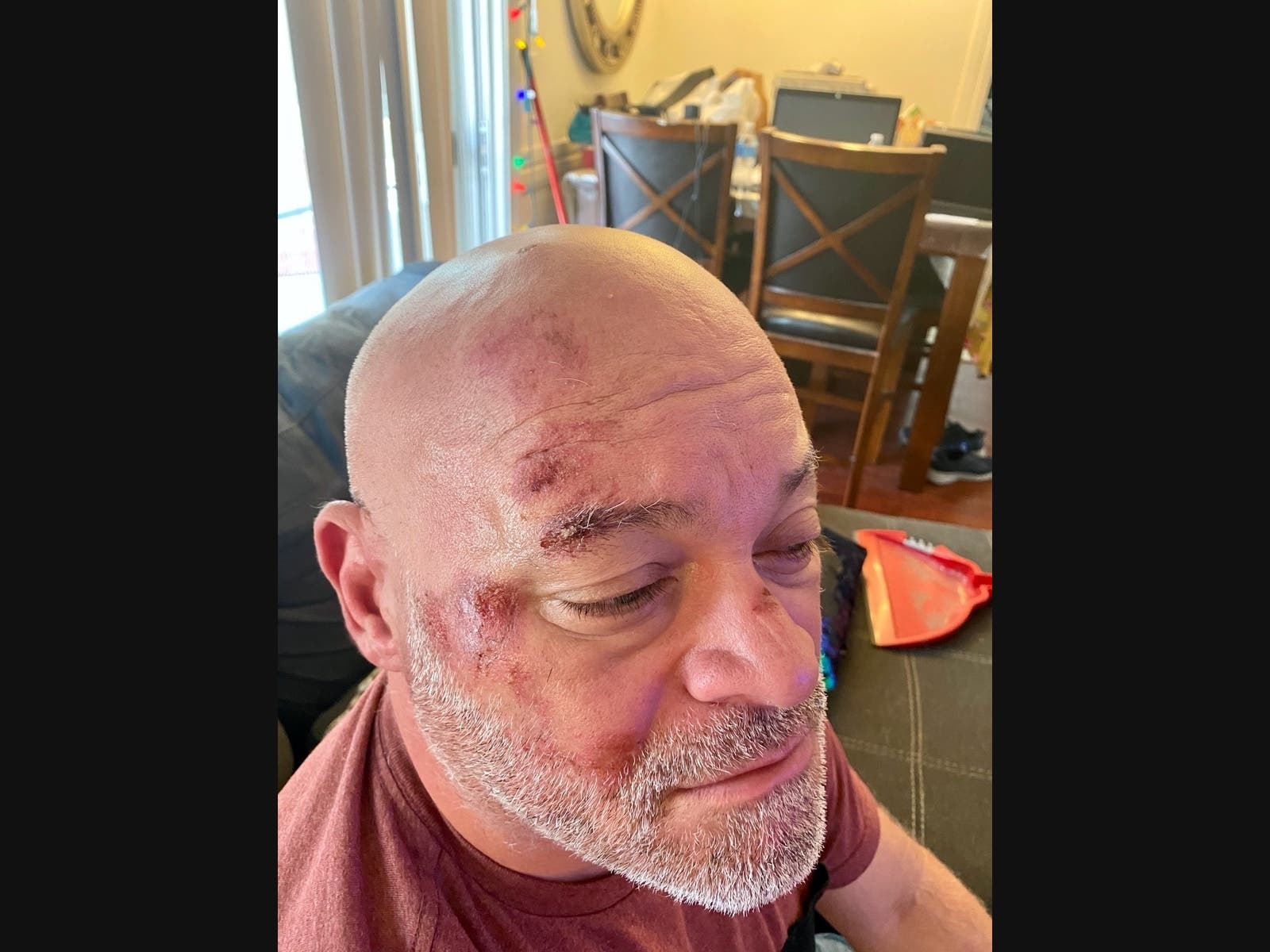 Jorge Games was beaten and robbed by looters earlier this week in Van Nuys.