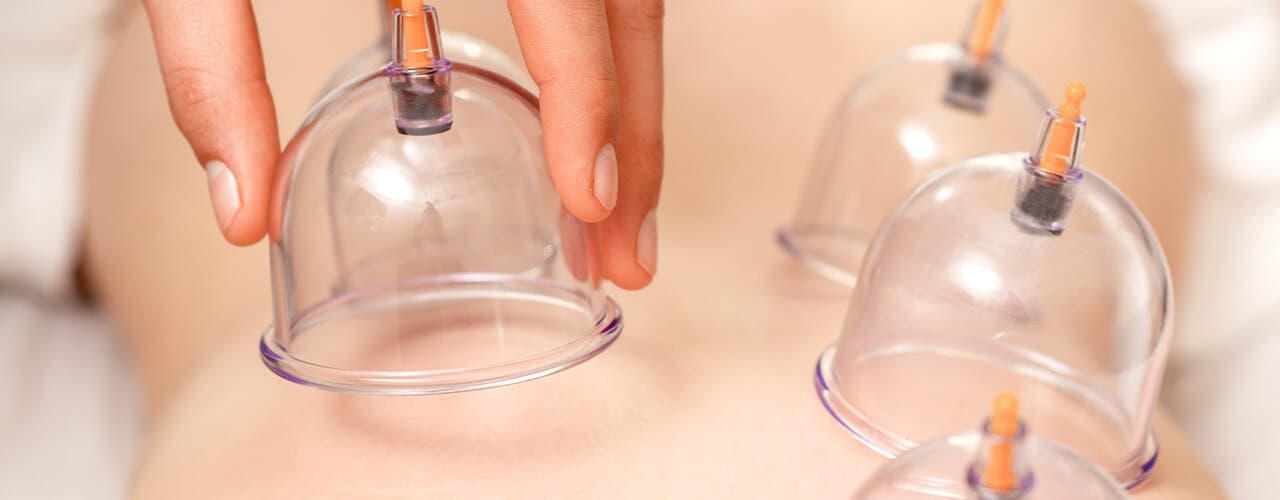 Live Awake Massage Now Offering Myofascial Decompression (Cupping)