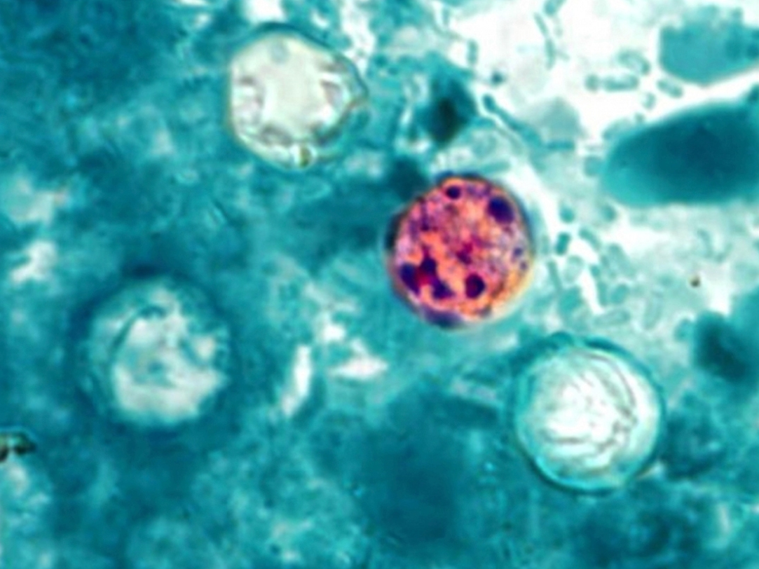 Parasite Infections In AL Rise As Cases Climb Nationwide | Across ...