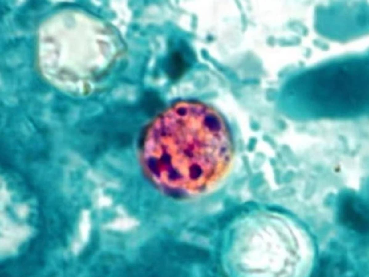 Cyclosporiasis