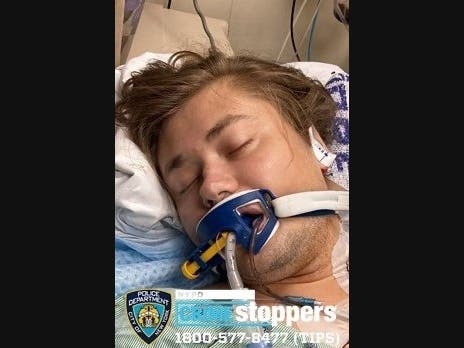 Police issued a nationwide alert in an attempt to identify the man discovered unconscious in the middle of a Bronx street.