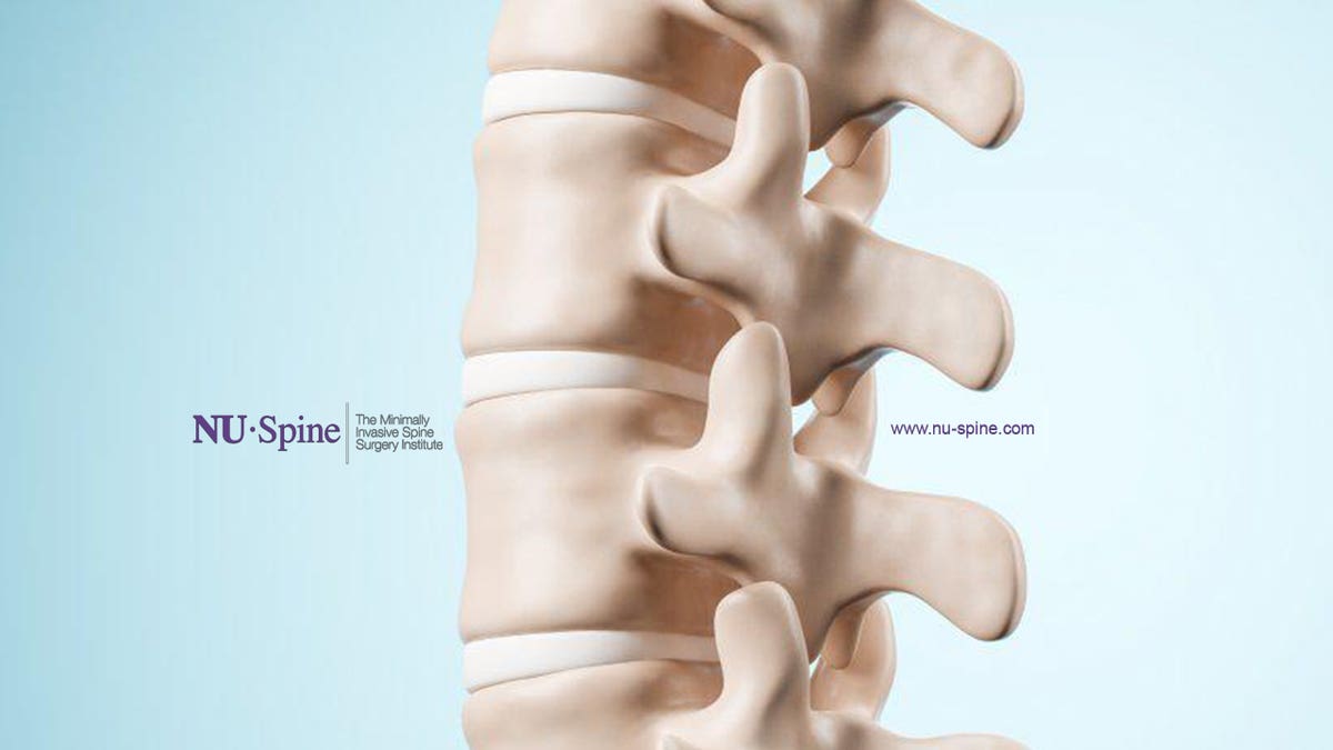 NU-Spine: The Minimally Invasive Spine Surgery Institute