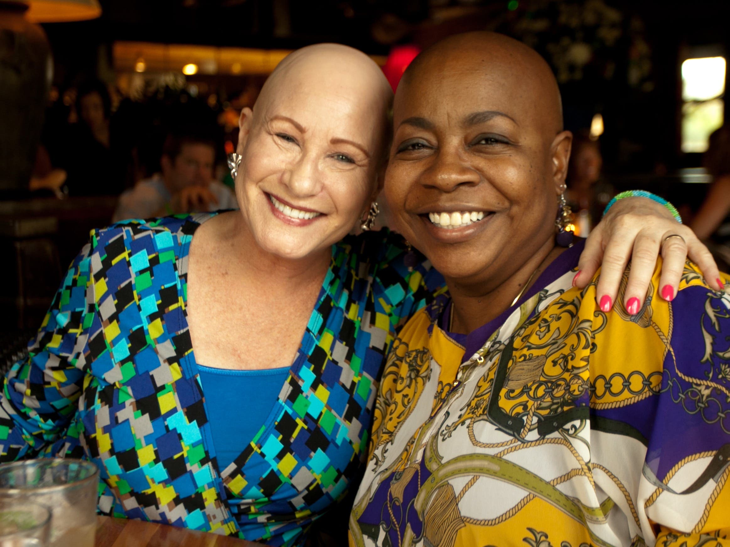 Bald Girls Do Lunch in Albany Region