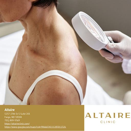 Skin Tag, Mole and Wart Removal in Fargo, ND This Fall at Altaire Clinic