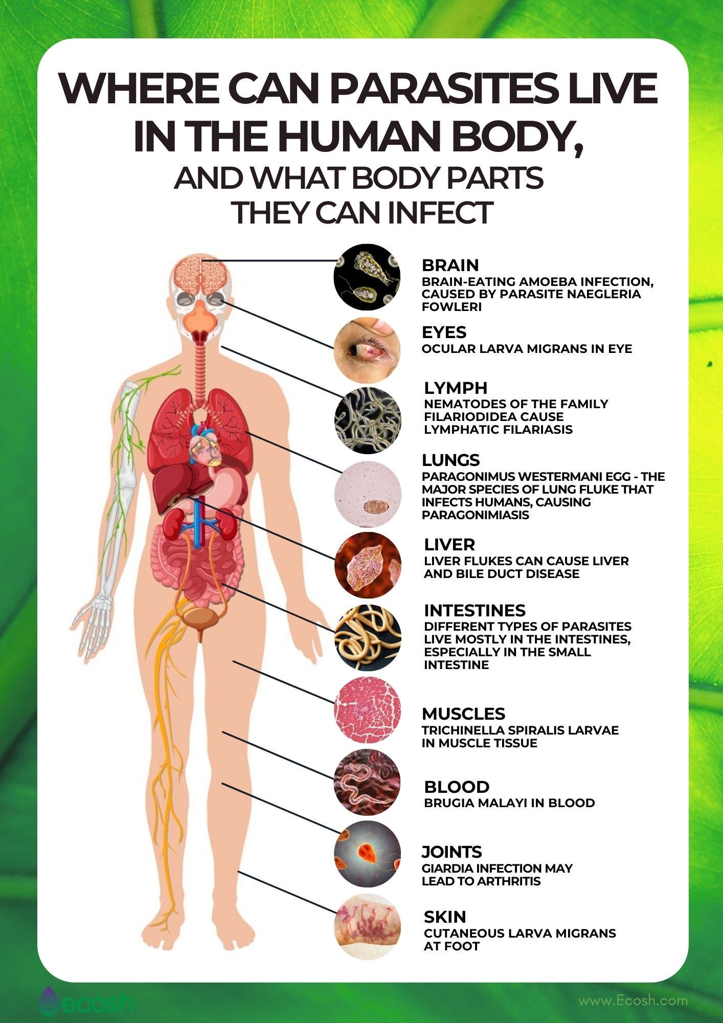 Parasites Tutorial Natural Treatments for Parasites - Philadelphia, PA Patch