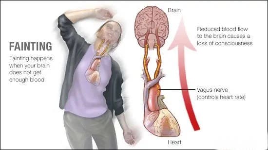 Understanding Syncope: Causes and Prevention Tips - Philadelphia, PA Patch
