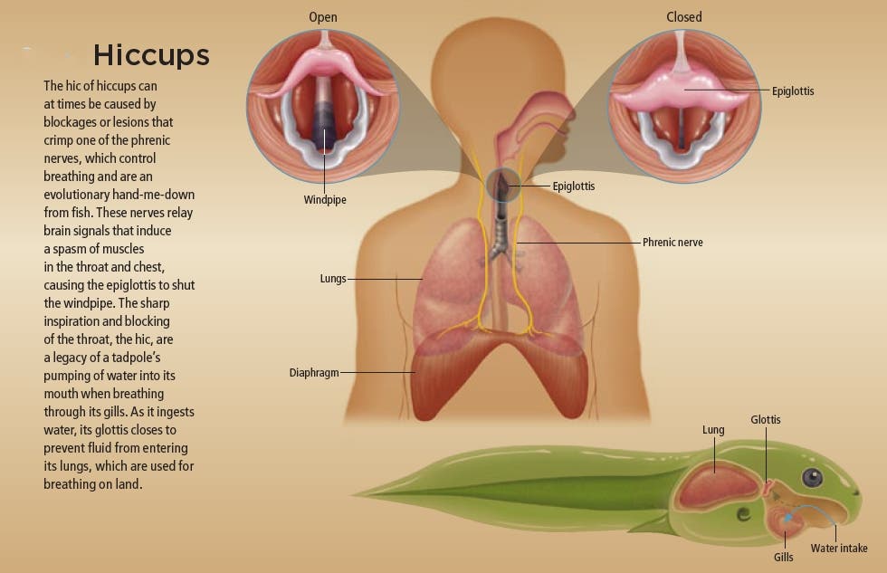 Photo inspiration: Visual Reference: Understanding Chronic Hiccups Causes Relief