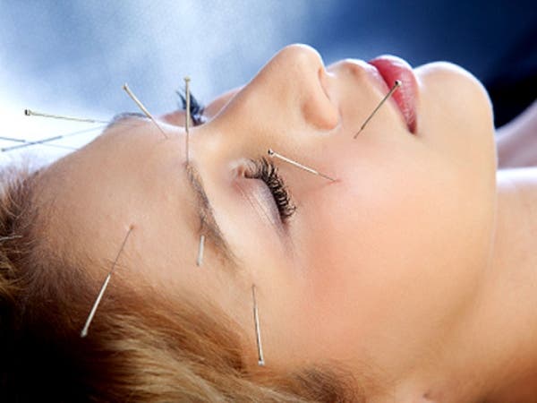 Acupuncture: An Effective Remedy for Headaches