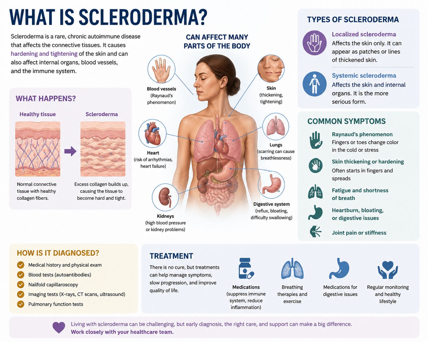Scleroderma: Causes, Symptoms, and Holistic Management