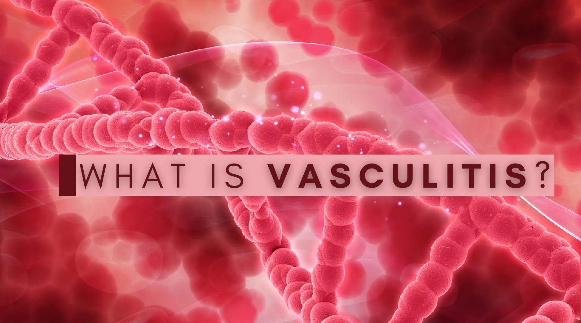 Vasculitis: Causes, Symptoms, Treatment, and Natural Care