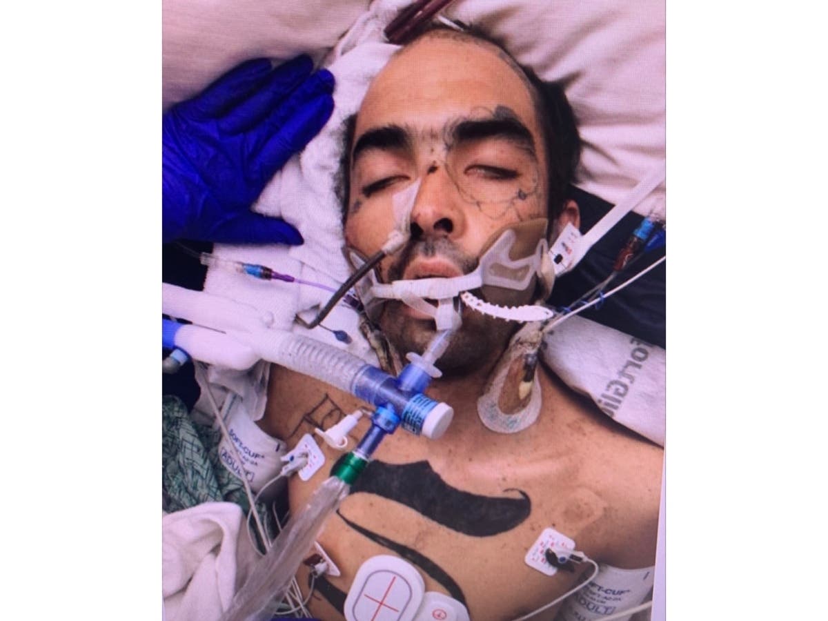 The Santa Monica Providence Saint John's Health Center is seeking the public's help in identifying a man in their care who is critically ill.