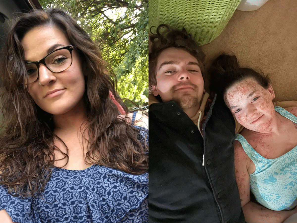  GA Woman To Get Skin Treatment In Thailand