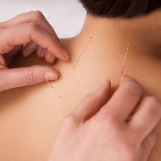 Sunyo Acupuncture Center