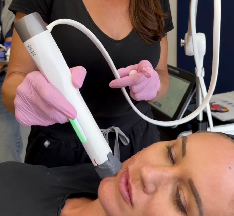 Collagen Loss & Loose Skin? Discover XERF Skin Tightening in San Diego