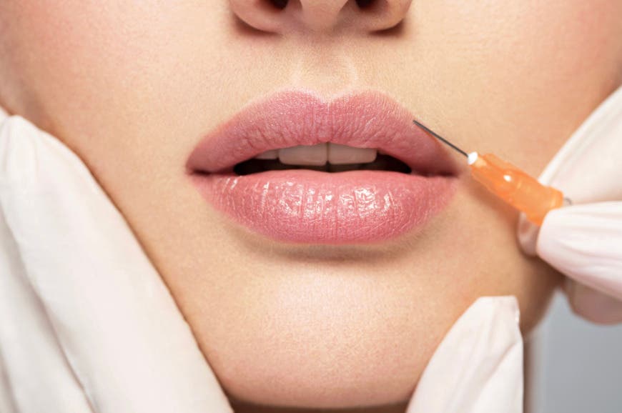 Looking for a Natural-Looking Aesthetic Injector in San Diego?