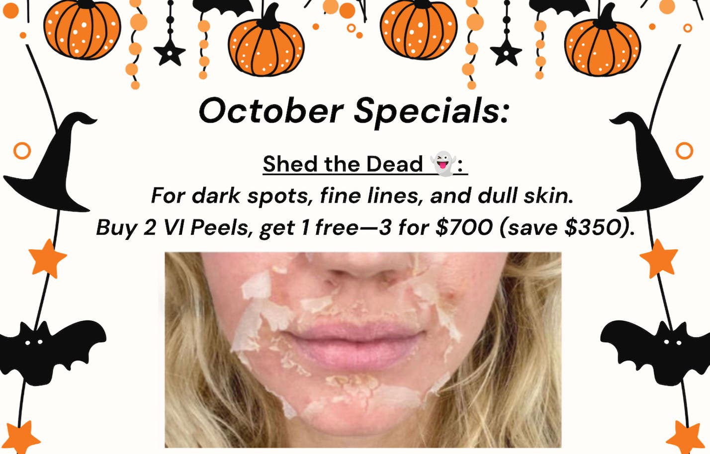 ๐ October Med Spa Specials in Point Loma: VI Peels + XERF Body Treatments