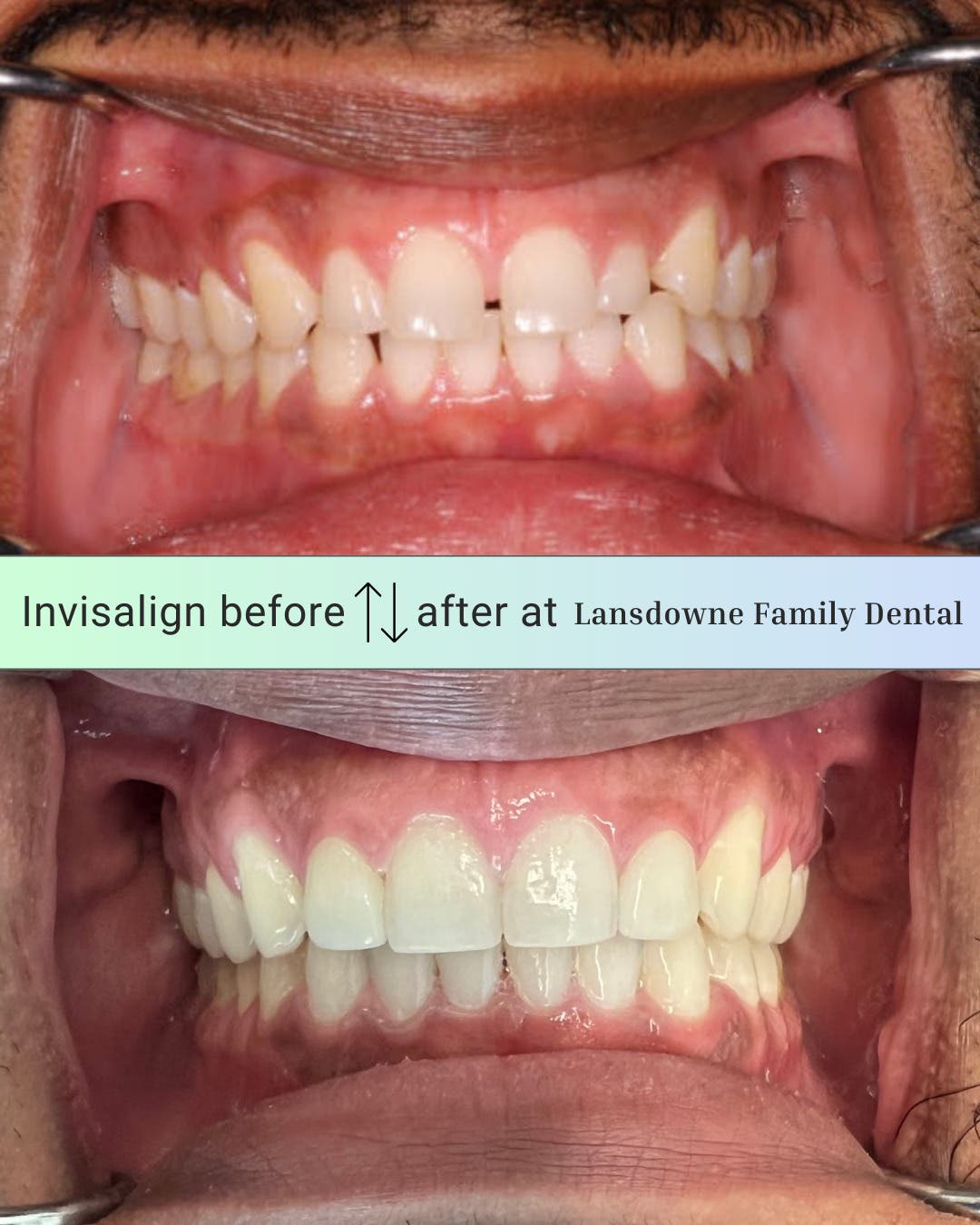 Lansdowne Family Dental - Implant and Cosmetic Dentist