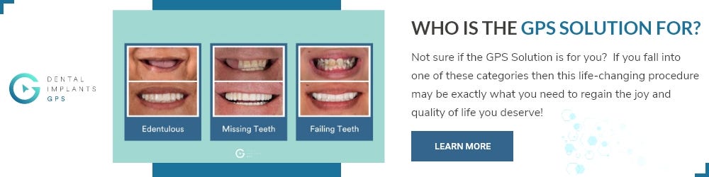 Dental Implants GPS