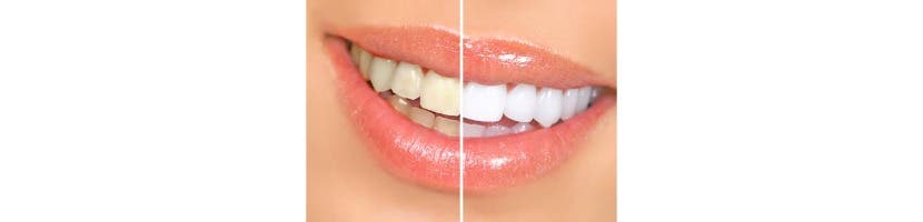 Garry S. Salvaggio, DDS