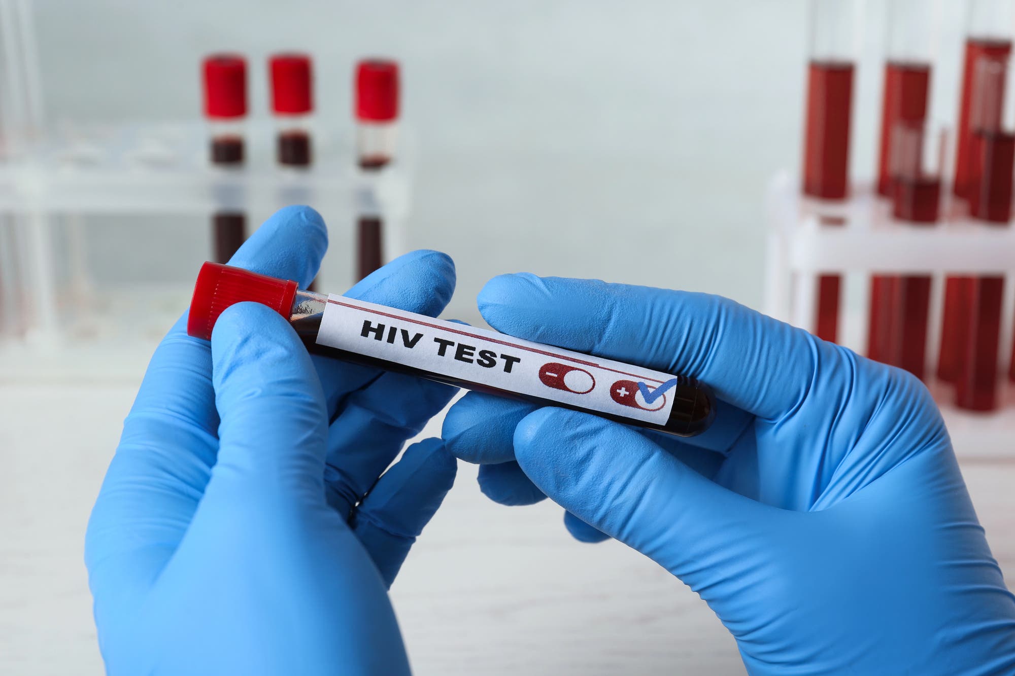 The Importance of Confidential HIV Testing and Early Awareness in Houston Communities