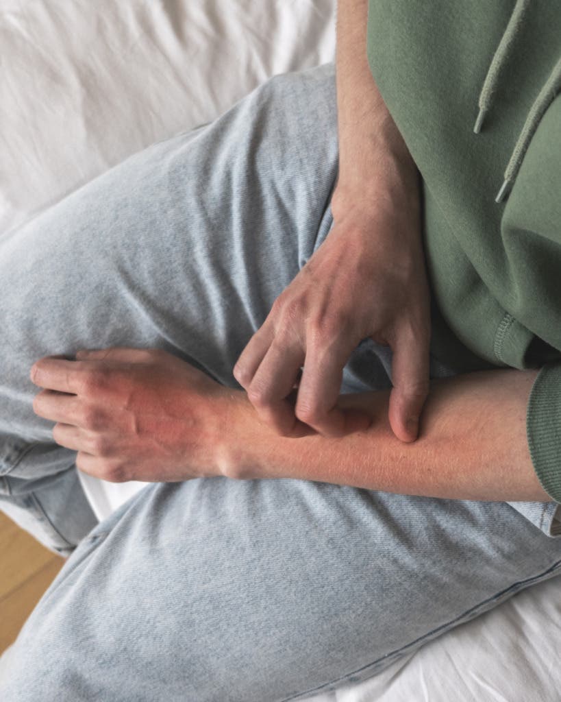 Excoriation Disorder Treatment | Friendly Recovery