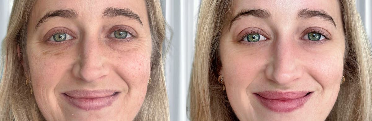 Beverly Wilshire Aesthetics Beverly Hills Medical Spa