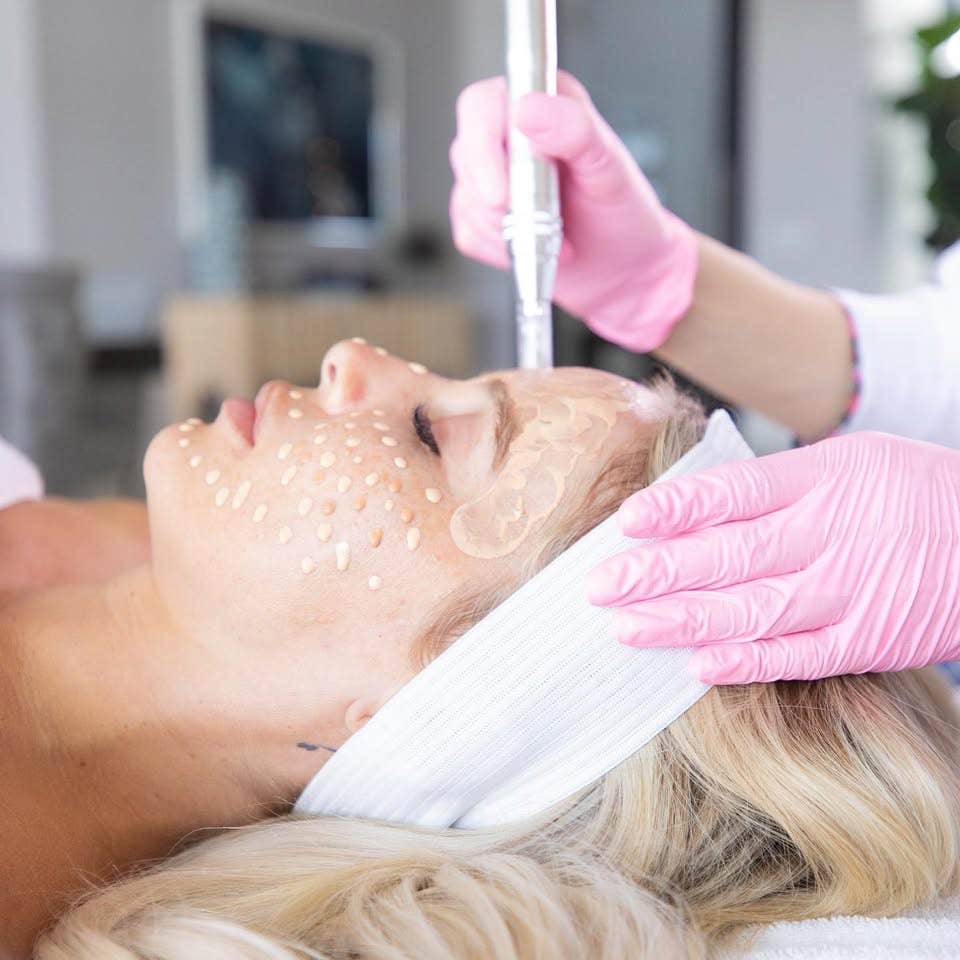 NKD Beauty by Vanessa | Facials | Microneedling Miami