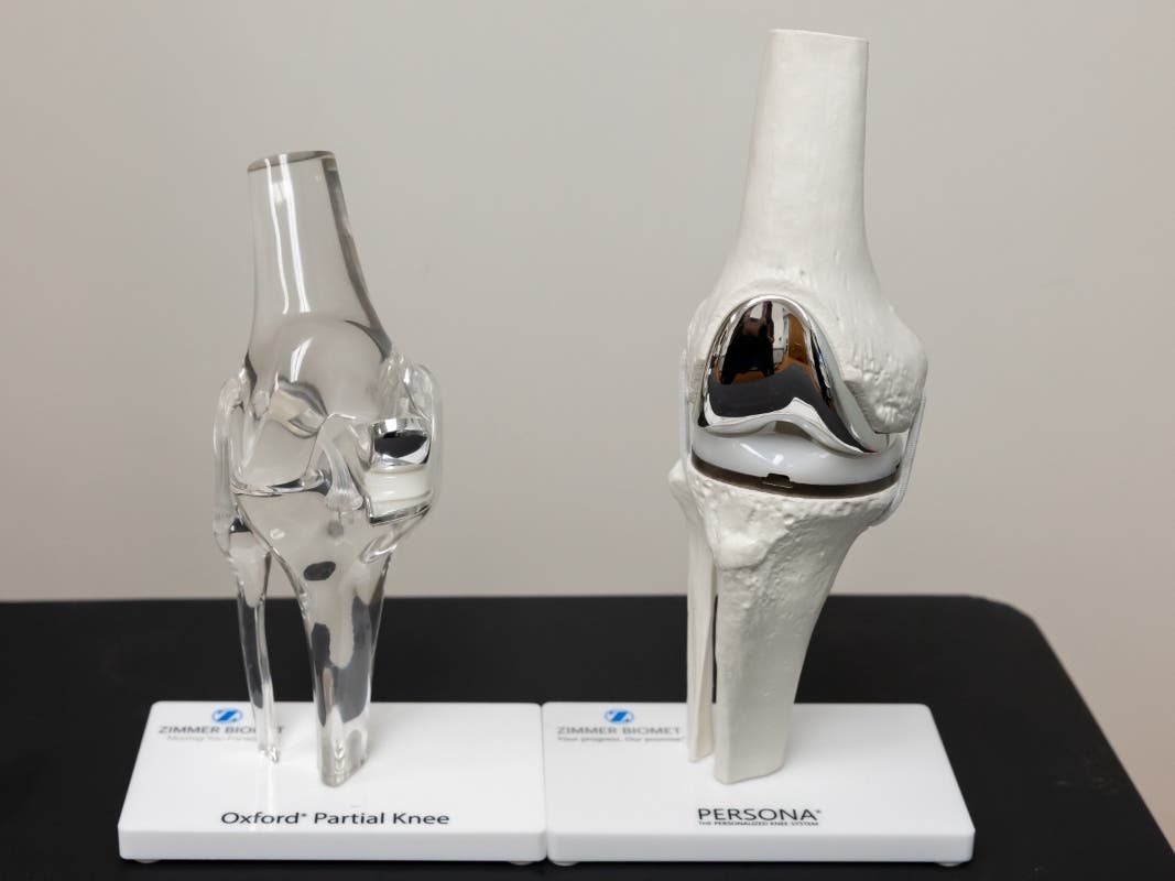 https://patch.com/img/cdn20/users/27193599/20260504/111909/styles/patch_image/public/dr-bisogno-knee-replacement-001___04111319468.jpg