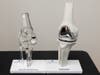 The Oxford cementless partial knee replacement implant.