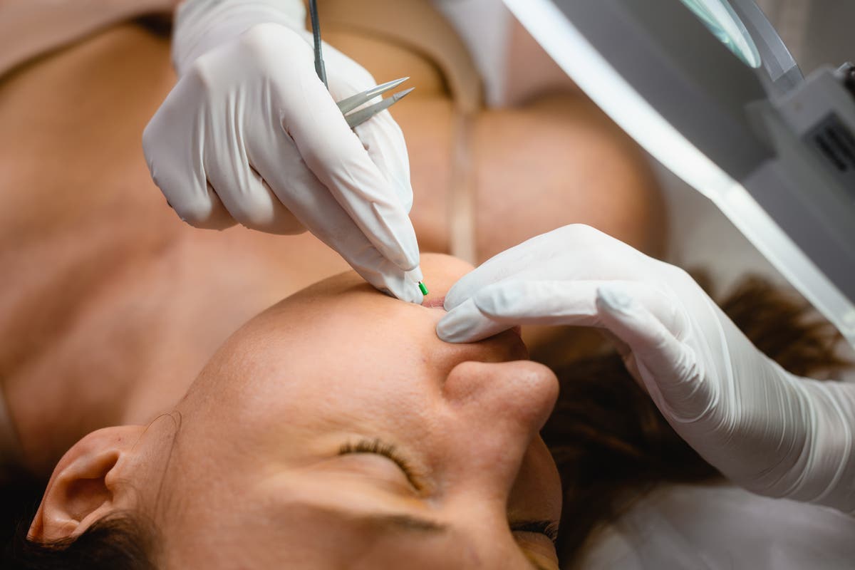 Naked Beauty Electrolysis