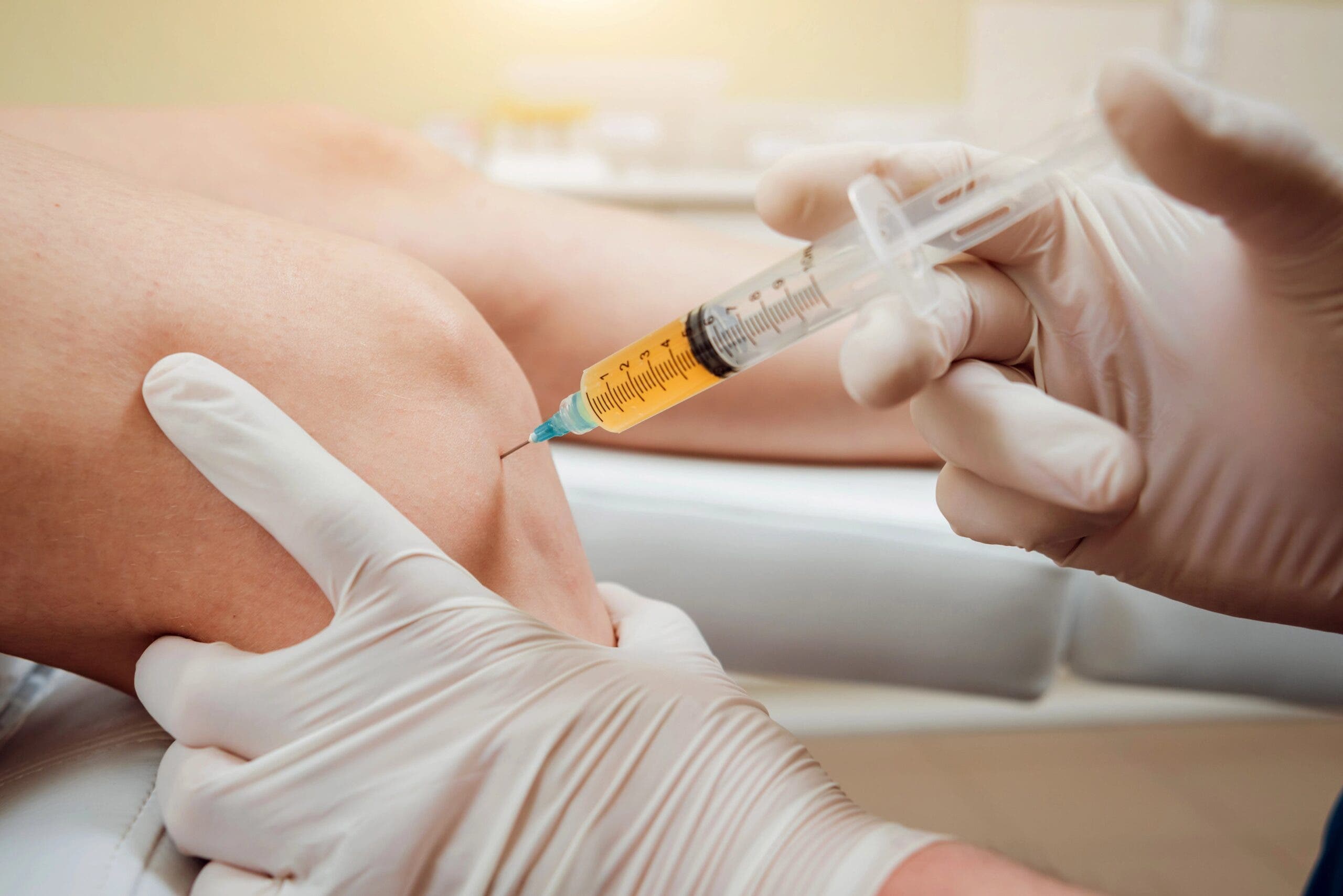PRP Therapy Emerges as a Regenerative Option for Pain Relief in Long Beach