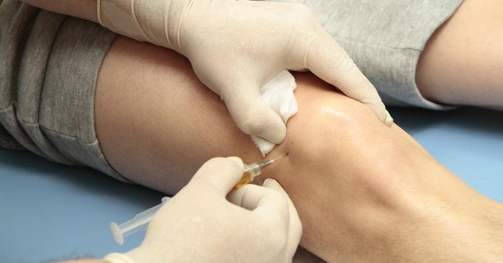 How Southern California Athletes Are Finding Relief with Overuse Injuries