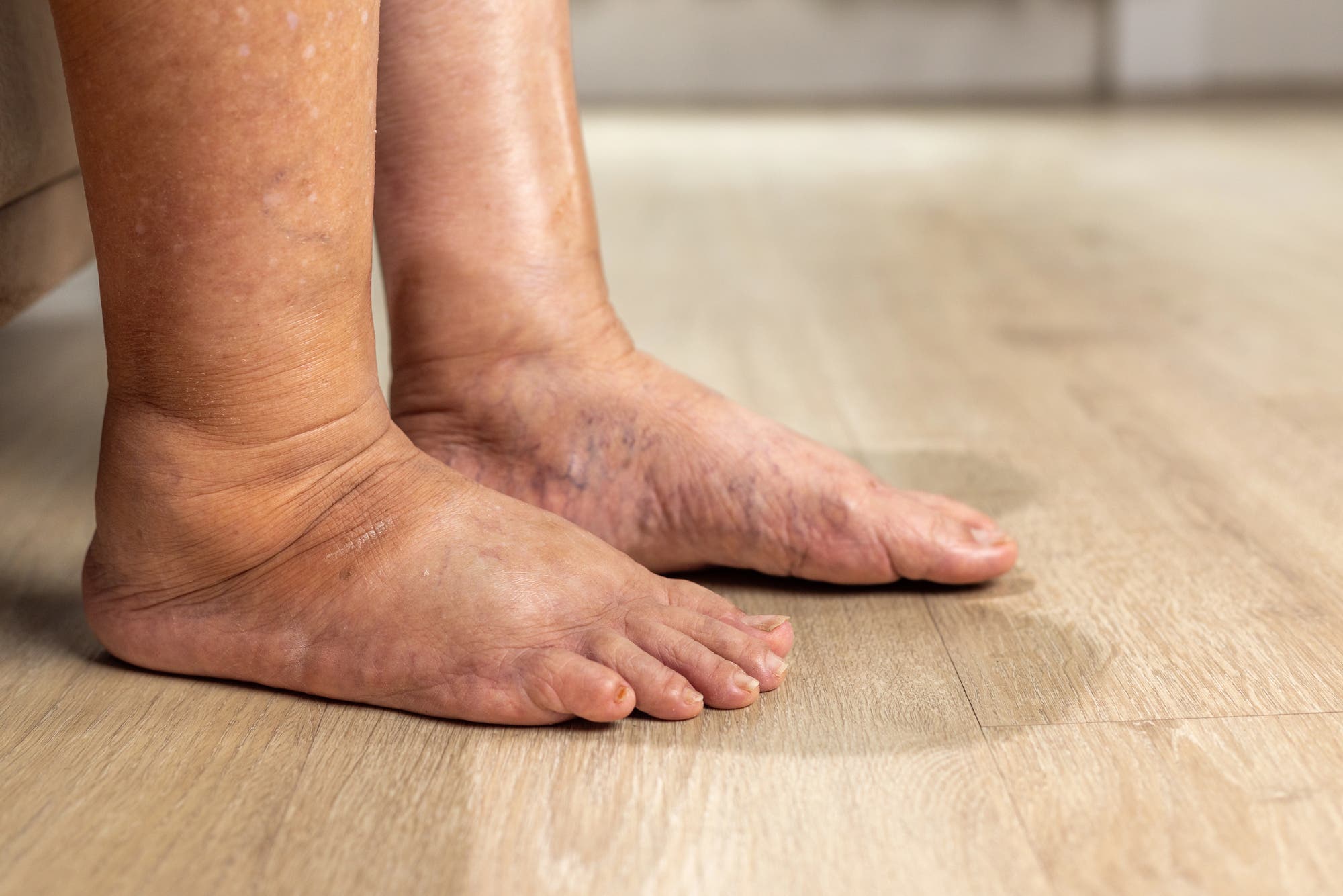 Why Regular Foot Care Matters for People With Diabetes in Cypress