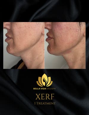 Bella Vida MedSpa