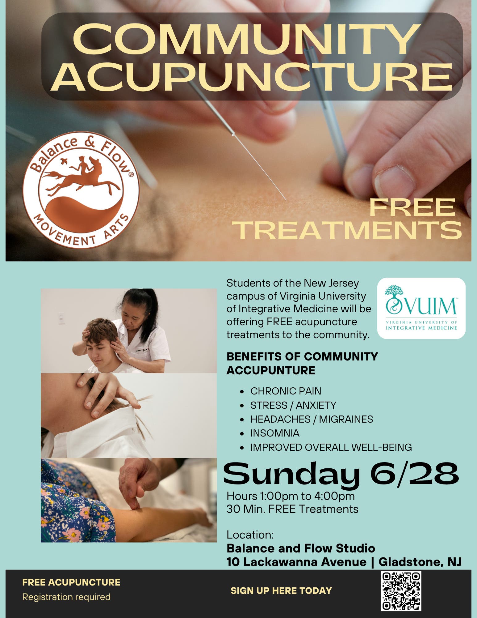 FREE Community Acupuncture