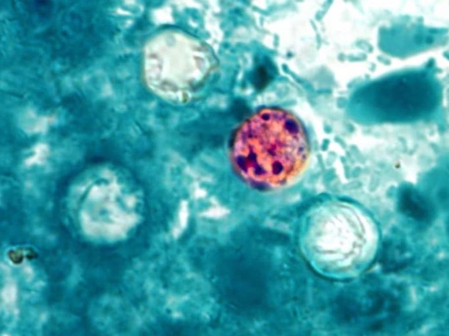 Parasite Cases Increasing In NJ: See Latest Data, Products To Avoid
