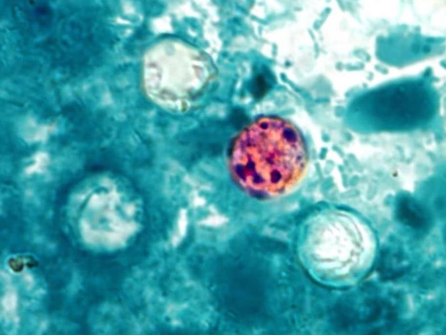 Parasite Cases In NYC: See Latest Data, Products To Avoid