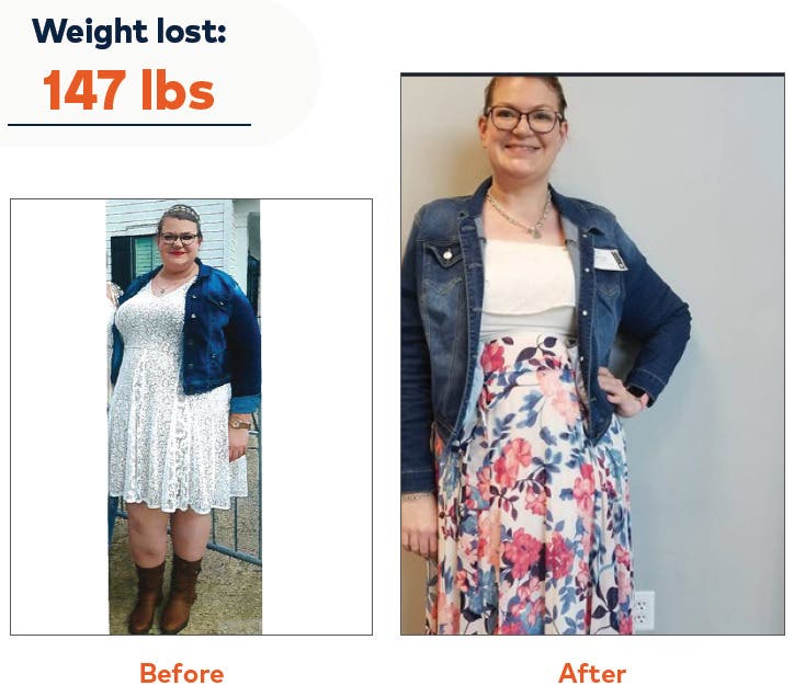 Free Weight Loss Seminar - start your journey to a new you!