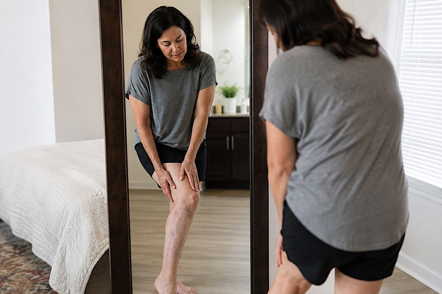Living with Leg Heaviness or Bulging Veins? Varicose Veins Are More Than A Cosmetic Issue