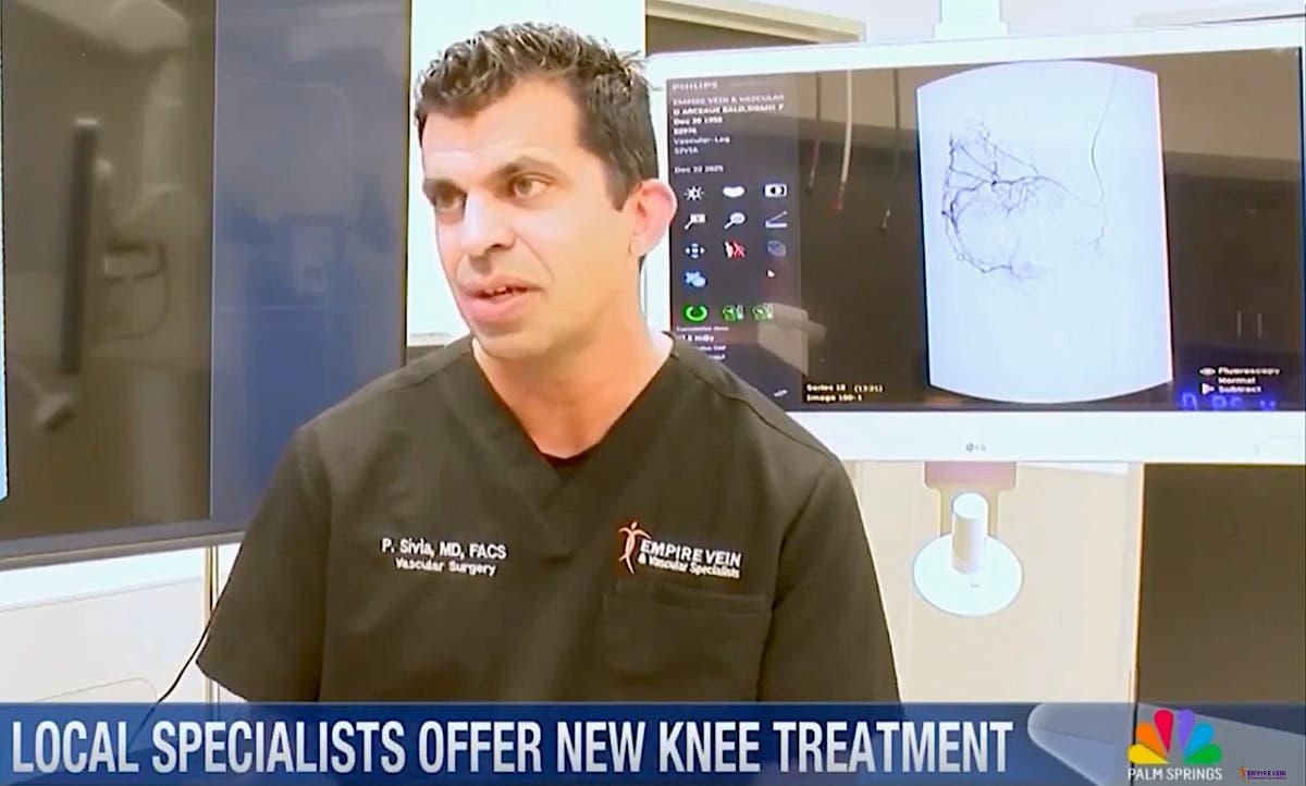Dr. Sivua of Empire Vein & Vascular Specialists discusses GAE on TV