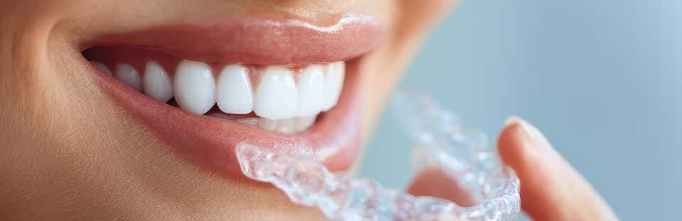Tacoma Advanced Dental | Dr. Petrie