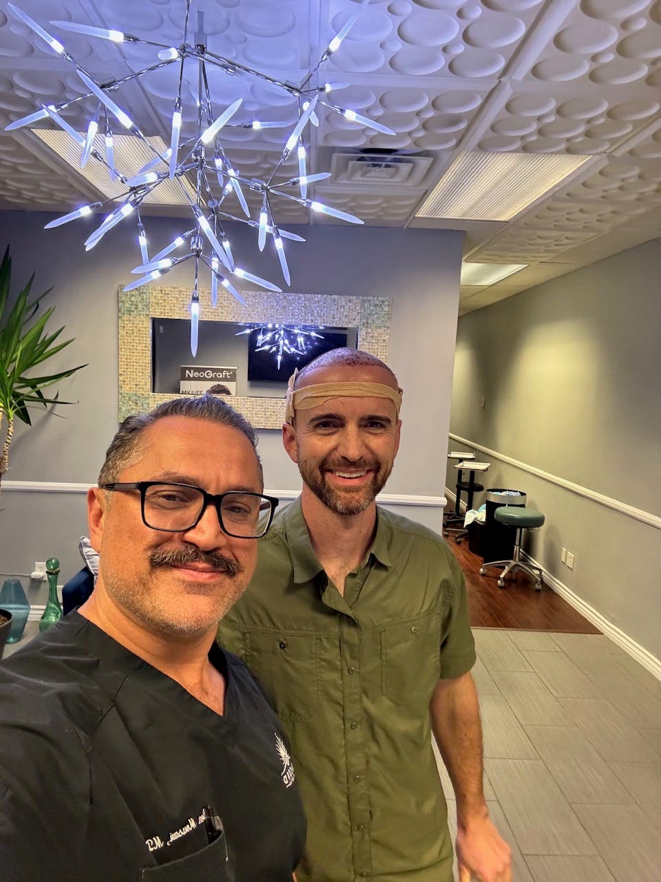 Considering a Hair Transplant in Los Angeles? Here's What Patients Should Know