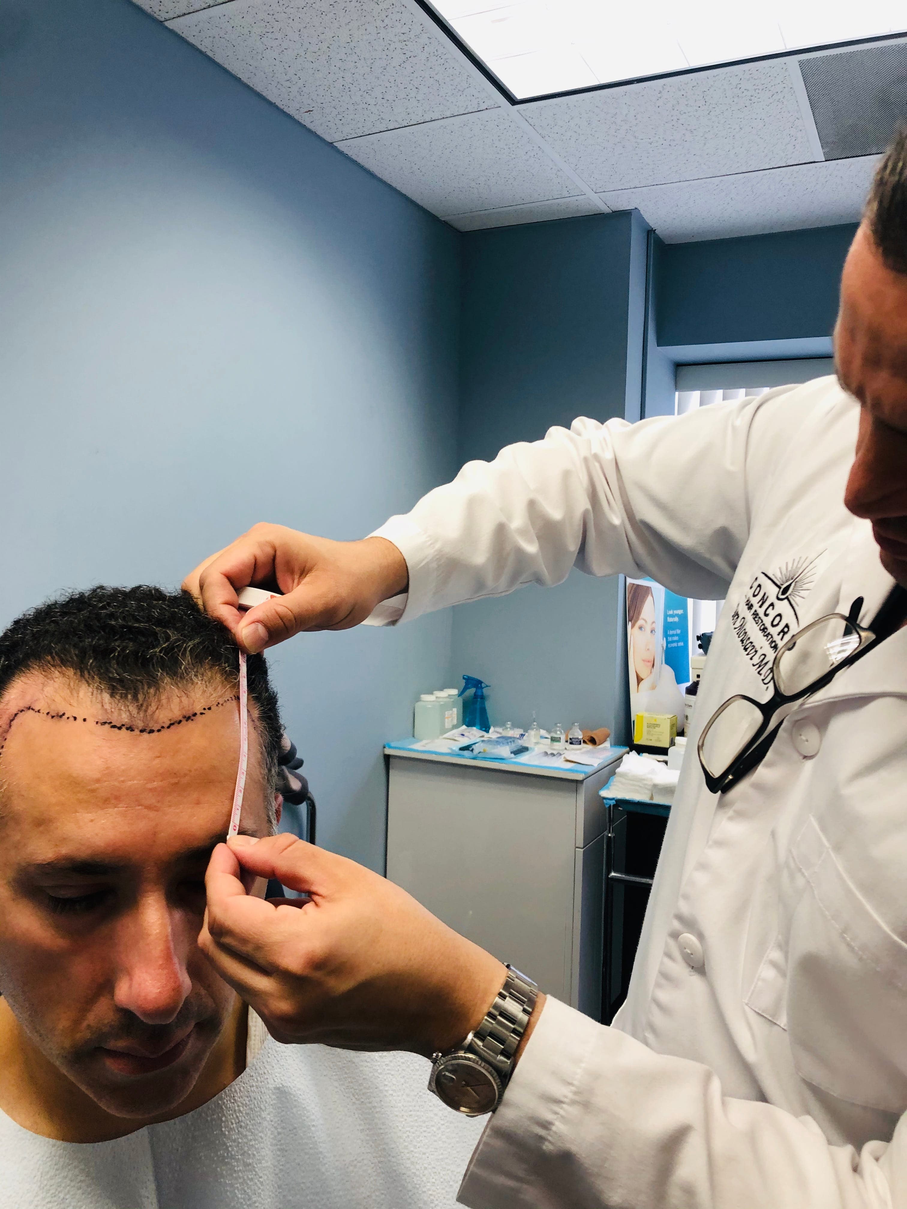 Why More Los Angeles Professionals Are Choosing Modern FUE Hair Restoration