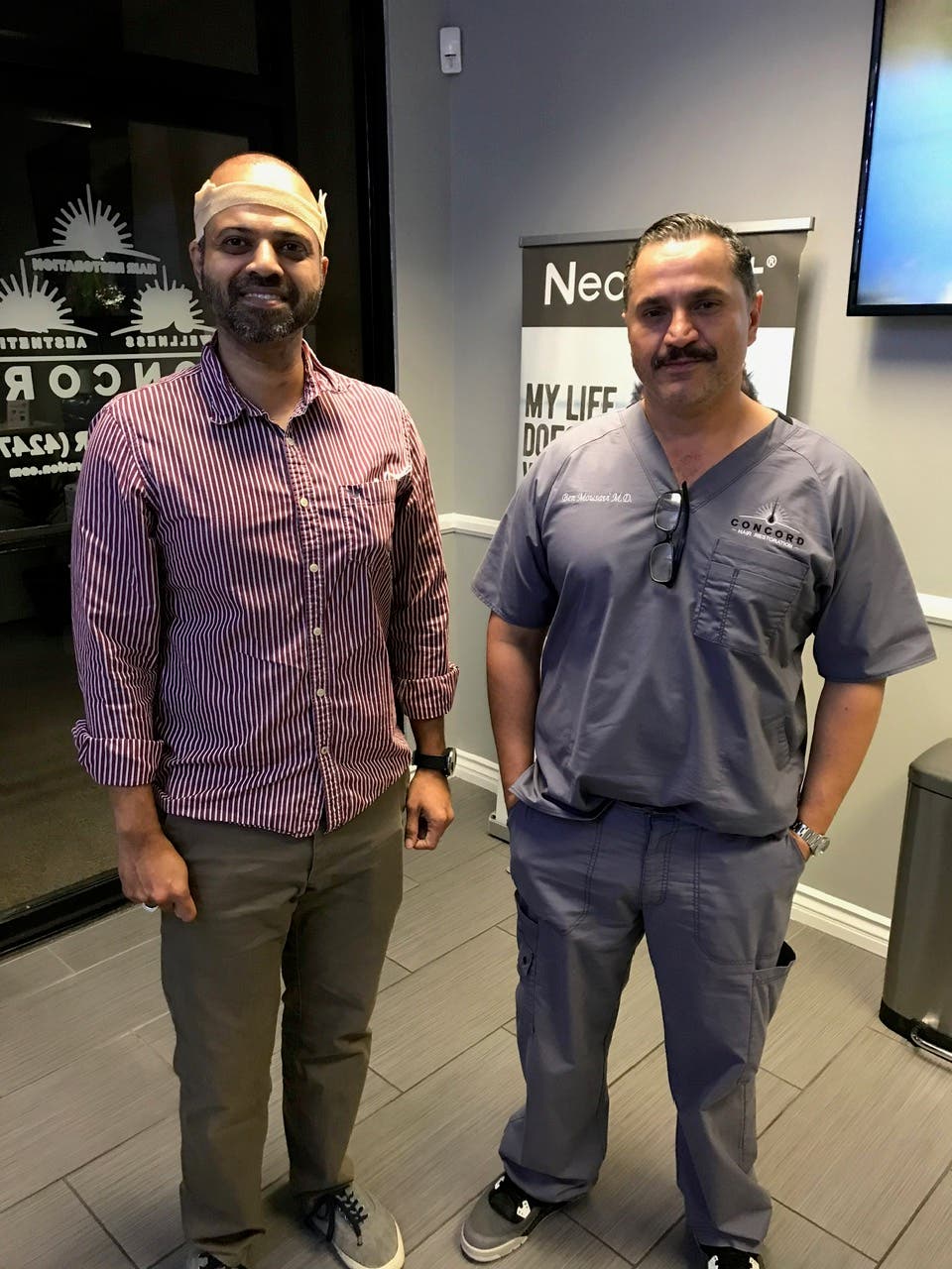 Considering Hair Restoration in Los Angeles? Learn About Advanced FUE Options