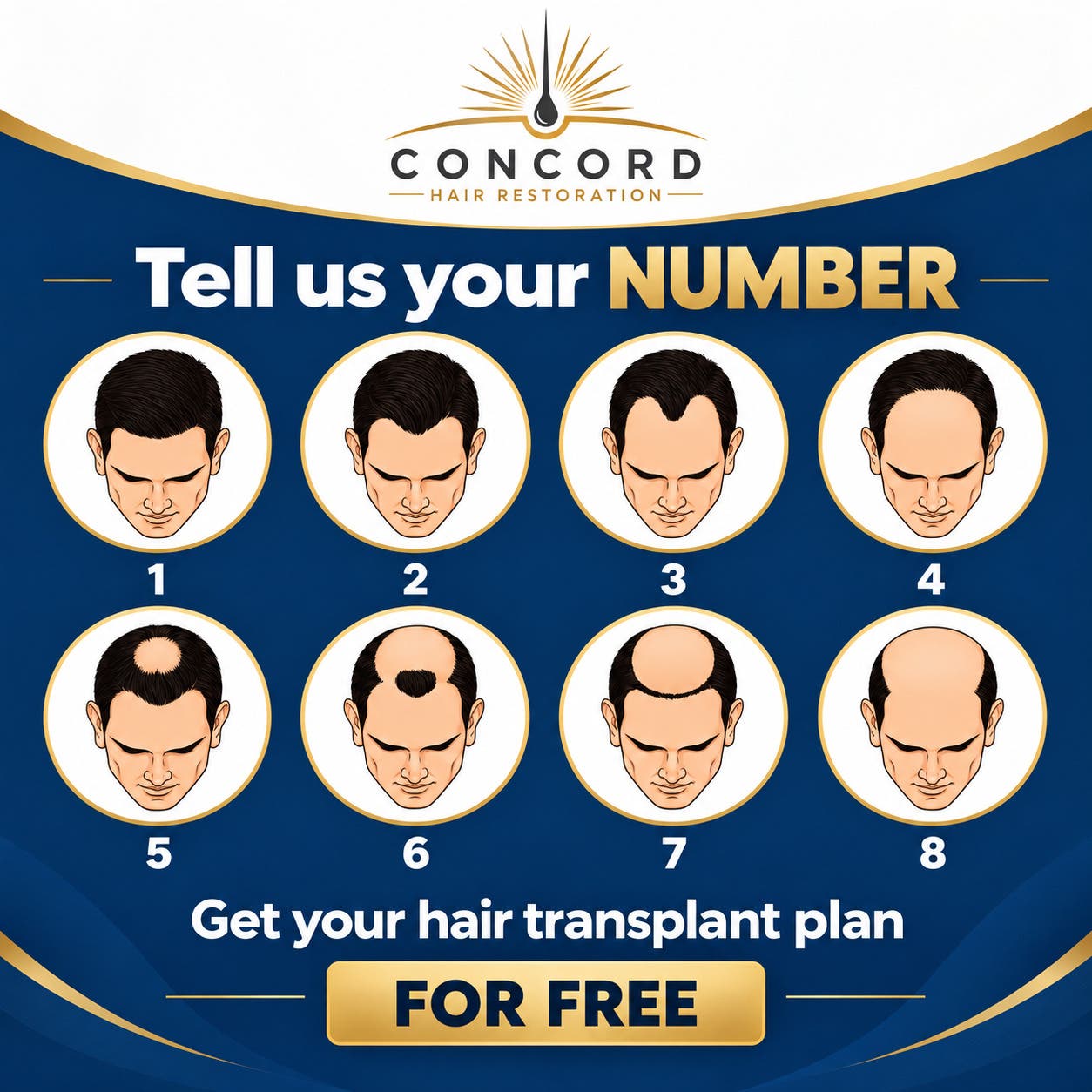 What Stage Is Your Hair Loss? Get a Personalized Hair Restoration Plan