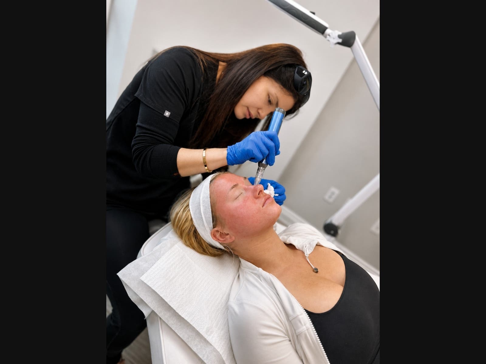 Microneedling at Refresh - Aesthetics & Wellness helps support collagen production and can improve the appearance of fine lines, uneven texture, and overall skin quality.