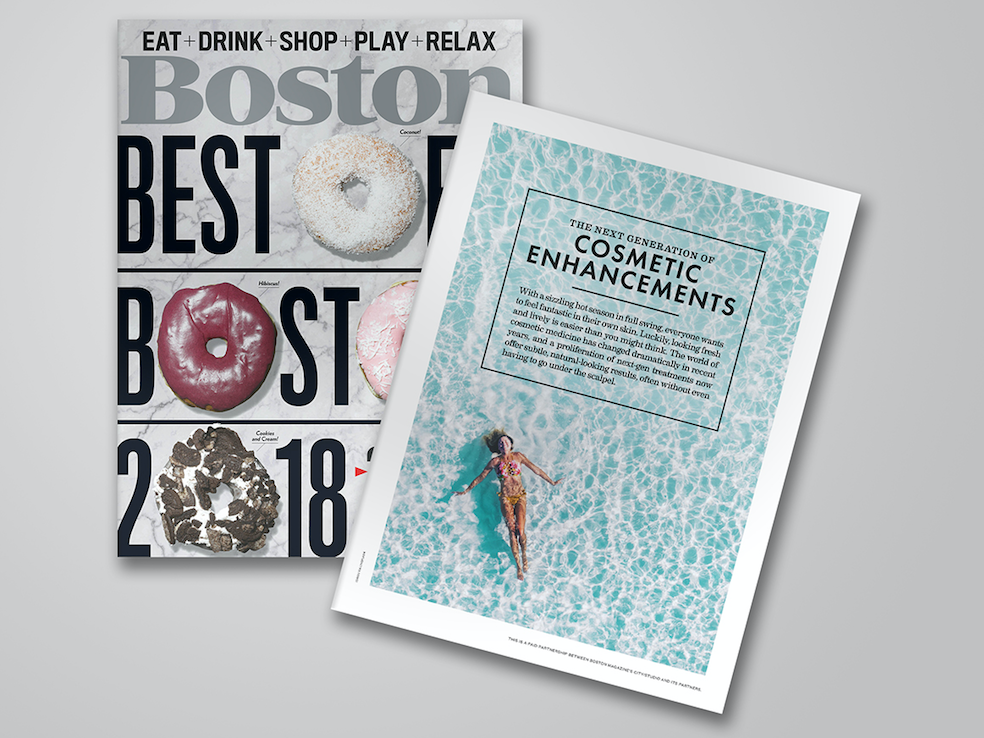 Best Hair Replacement Systems in Boston