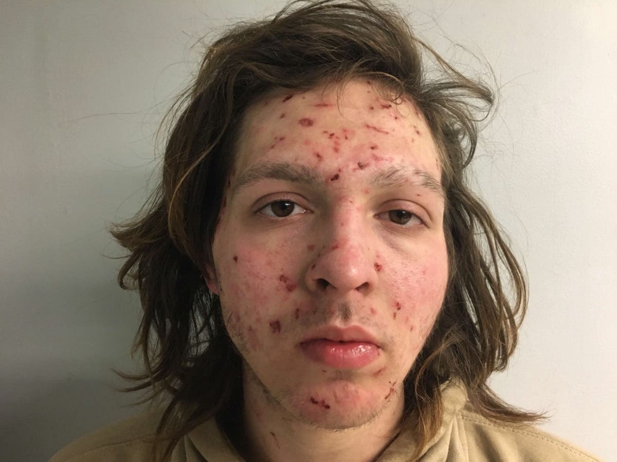 Timothy Casey has been arrested several times in half a dozen New Hampshire communities during the past five years. He now faces a burglary charge.
