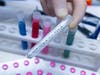 Nearly 124,500 negative test results have been reported in Maryland, while over 31,500 have tested positive for the coronavirus.